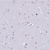 Anti-SPN antibody produced in rabbit Prestige Antibodies&#174; Powered by Atlas Antibodies, affinity isolated antibody, buffered aqueous glycerol solution