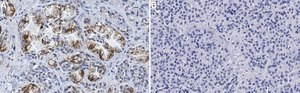 Anti-SLC12A2 Antibody, clone 1J6 ZooMAb&#174; Rabbit Monoclonal recombinant, expressed in HEK 293 cells