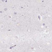 Anti-PRL antibody produced in rabbit Prestige Antibodies&#174; Powered by Atlas Antibodies, affinity isolated antibody