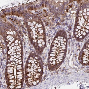 Anti-CFL1 antibody produced in rabbit Prestige Antibodies&#174; Powered by Atlas Antibodies, affinity isolated antibody, buffered aqueous glycerol solution