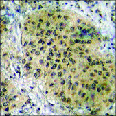 Anti-phospho-HSL (pSer552) antibody produced in rabbit affinity isolated antibody