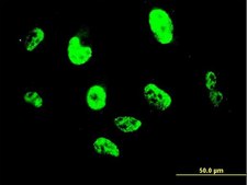 Monoclonal Anti-SNAI2 antibody produced in mouse clone 3C12, purified immunoglobulin, buffered aqueous solution