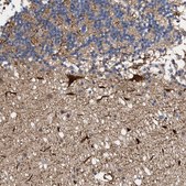 Anti-ALDOC antibody produced in rabbit Prestige Antibodies&#174; Powered by Atlas Antibodies, affinity isolated antibody, buffered aqueous glycerol solution