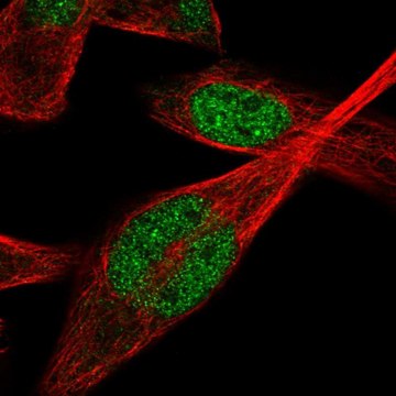 Anti-IPMK antibody produced in rabbit Prestige Antibodies&#174; Powered by Atlas Antibodies, affinity isolated antibody