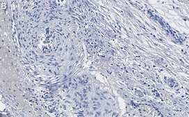 Anti-phospho-HSP27 Ser82 Antibody, clone 1O17 ZooMAb&#174; Rabbit Monoclonal recombinant, expressed in HEK 293 cells