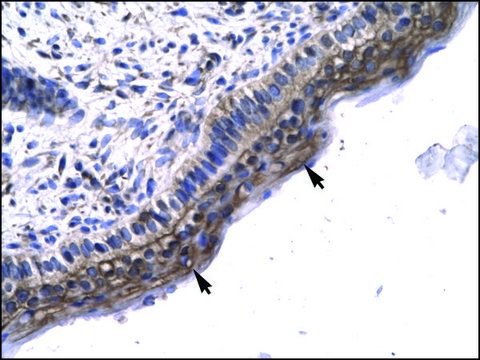 Anti-LEF1 (AB1) antibody produced in rabbit affinity isolated antibody