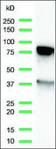 Anti-KU80 antibody, Rabbit monoclonal clone SP130, recombinant, expressed in proprietary host, affinity isolated antibody