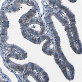 Anti-STIM1 antibody produced in rabbit Prestige Antibodies&#174; Powered by Atlas Antibodies, affinity isolated antibody, buffered aqueous glycerol solution