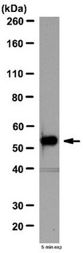 Anti-Fibulin-5 Antibody from rabbit, purified by affinity chromatography