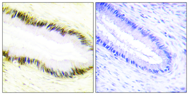 Anti-NR2F6 antibody produced in rabbit affinity isolated antibody