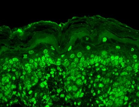 Monoclonal Anti-CACNB2 antibody produced in mouse clone S8B-1, 1&#160;mg/mL, purified immunoglobulin