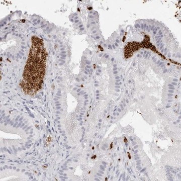 Anti-SPTA1 antibody produced in rabbit Prestige Antibodies&#174; Powered by Atlas Antibodies, affinity isolated antibody, buffered aqueous glycerol solution