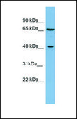Anti-POLB antibody produced in rabbit affinity isolated antibody