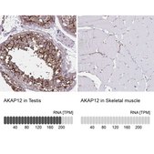 Anti-AKAP12 antibody produced in rabbit Prestige Antibodies&#174; Powered by Atlas Antibodies, affinity isolated antibody, buffered aqueous glycerol solution