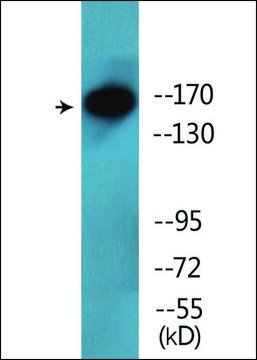 Anti-phospho-NFAT5/TonEBP (pSer155) antibody produced in rabbit affinity isolated antibody