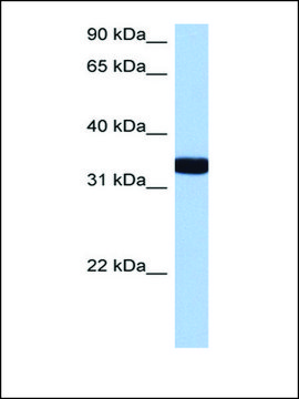 Anti-GIMAP1 antibody produced in rabbit affinity isolated antibody