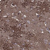 Anti-SLC1A2 antibody produced in rabbit Prestige Antibodies&#174; Powered by Atlas Antibodies, affinity isolated antibody, buffered aqueous glycerol solution