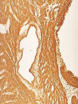 Anti-Nitrotyrosine Antibody, clone 1A6 clone 1A6, Upstate&#174;, from mouse