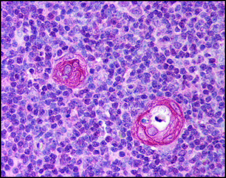 Anti-VISA (AB2) antibody produced in rabbit affinity isolated antibody, buffered aqueous solution