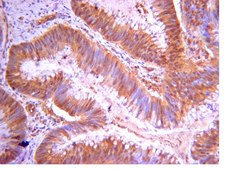 Anti-PI3 Kinase Antibody, p110&#946; from rabbit, purified by affinity chromatography