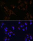 Anti-CD133 antibody produced in rabbit