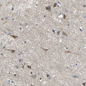 Anti-PRKCA antibody produced in rabbit Ab1, Prestige Antibodies&#174; Powered by Atlas Antibodies, affinity isolated antibody, buffered aqueous glycerol solution