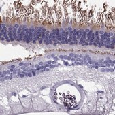 Anti-PDE6A antibody produced in rabbit Prestige Antibodies&#174; Powered by Atlas Antibodies, affinity isolated antibody, buffered aqueous glycerol solution