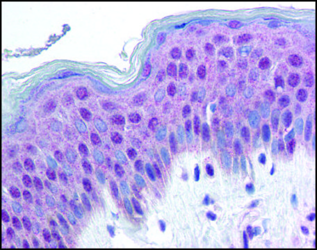 Anti-HMGN1 antibody produced in rabbit affinity isolated antibody, buffered aqueous solution