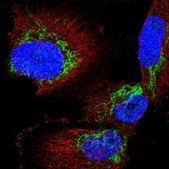 Anti-AGK antibody produced in rabbit Prestige Antibodies&#174; Powered by Atlas Antibodies, affinity isolated antibody, buffered aqueous glycerol solution
