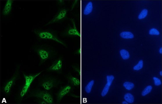 Anti-Supervillin antibody produced in rabbit affinity isolated antibody, buffered aqueous solution