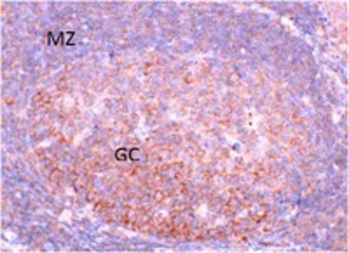 Anti-Fbxo7 Antibody