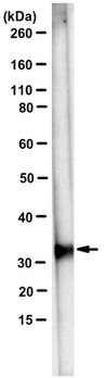 Anti-Ketohexokinase Isoform C Antibody, clone 5F1-3F5 clone 5F1-3F5, from mouse