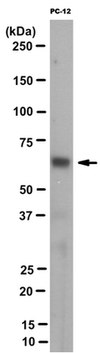 Anti-IMPDH1 Antibody, clone 4F9.1 clone 4F9.1, from mouse
