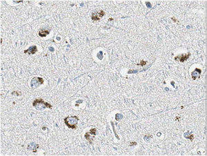 Anti- GABAA Antibody &#947;2 Subunit, clone KC4-8A7 clone KC4-8A7, from mouse