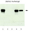 Anti-Progesterone Receptor B Antibody, clone 250/H11 clone 250/H11, from mouse