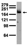 Anti-Sodium channel Nav1.7 Antibody, clone N68/6 clone N68/6, from mouse