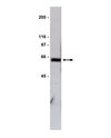 Anti-GST Tag Antibody Upstate&#174;, from rabbit