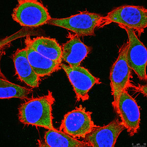 Anti-ZNF175 (OTK18) Antibody, clone 211&#8722;3.1&#8722;1 clone 211−3.1−1, from mouse