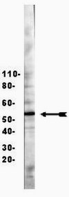 Anti-HNF3&#946;/FOXA2 Antibody Upstate&#174;, from rabbit