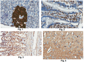 Anti-TrpV6 Antibody, clone 4A5.1 culture supernatant, clone 4A5.1, from mouse