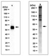 Anticorps anti-CYP11B1, clone 80-7 clone 80-7, from rat