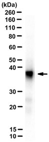 Anti-SET-beta, clone 3D10E2 clone 3D10E2, from mouse